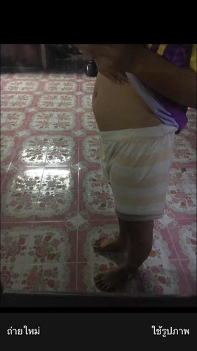 ขอดูท้องคุณแม่14+3w หน่อยคะ👼👼