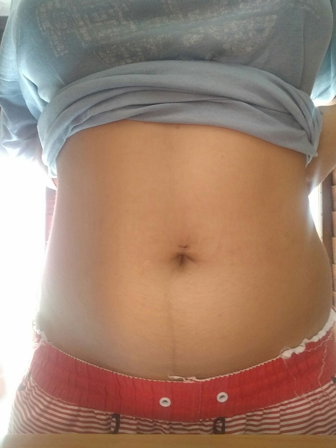 17 w 5 วัน แล้วคะ แต่ท้องยังไม่ค่อยใหญ่มากคะ