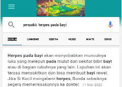 penyakit Herpes pada bayi
