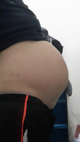 37weeks......mababa na po ba???