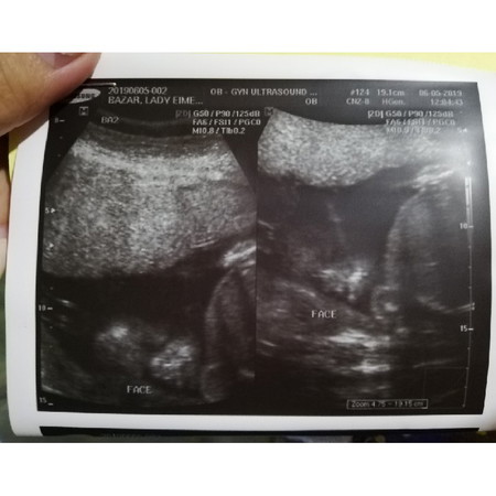 24 Weeks And 5 Day - BABY BOY