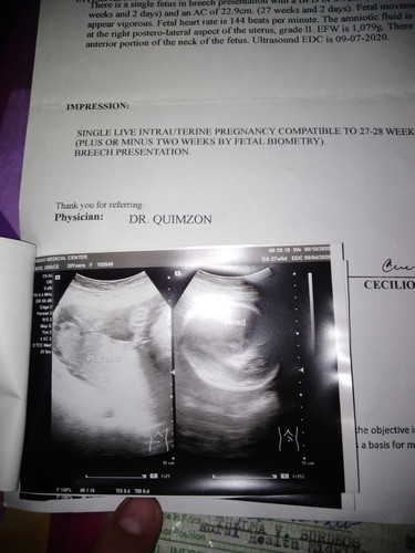 ANO PO BA IBIG SABIHIN NITO SA PICTURE NG ULTRASOUND KO?