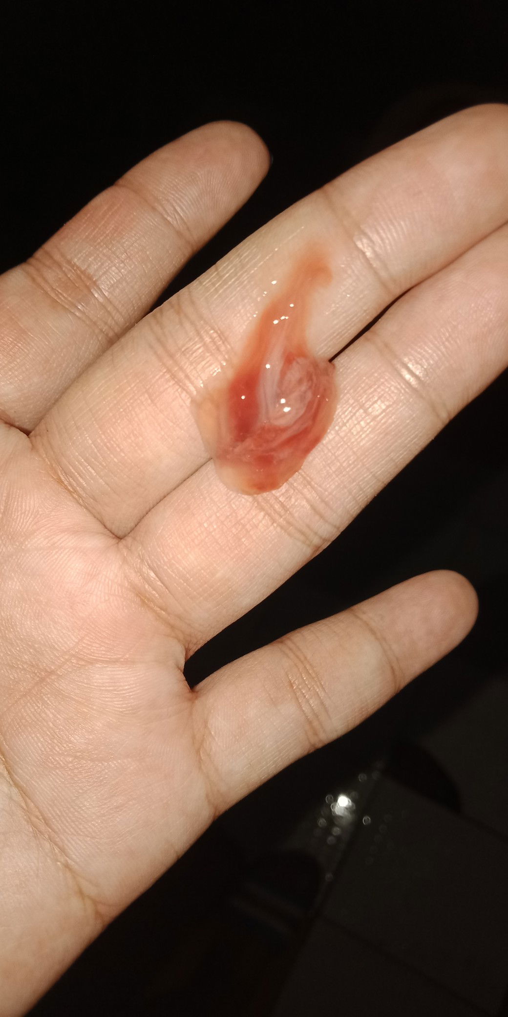 มูกเลือดใช่มั้ยค่ะแม่ๆ