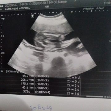 อยากรุ้เพศจร้ ช/ญ