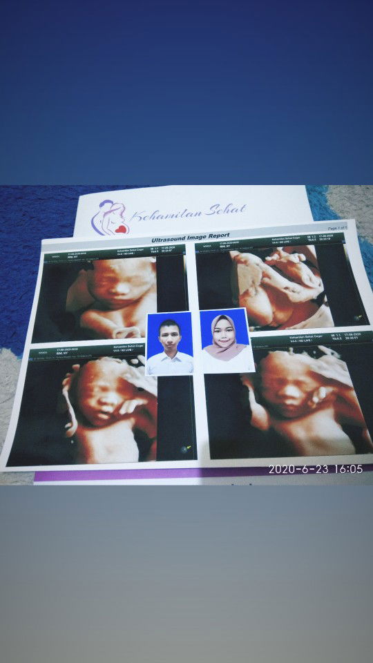 Riny Rachmawan profile icon