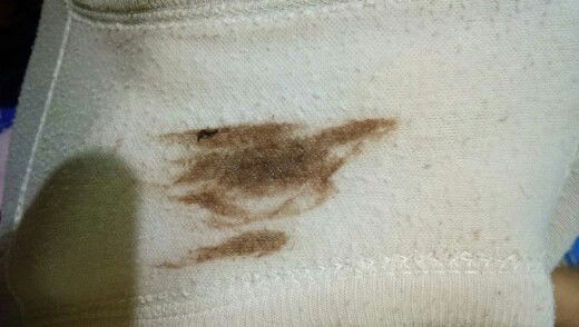 Udah minum ustrogestan 200gr 2x1 tpi flek