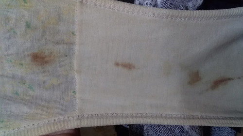 Mag 4 months delayed. Irreg menstruation cyle