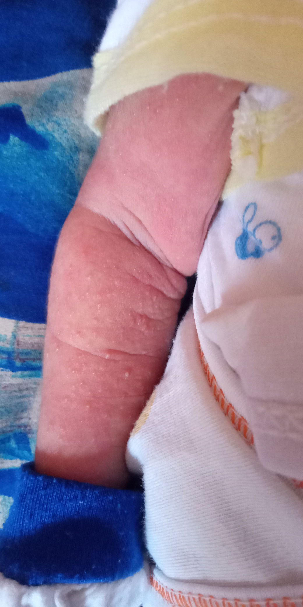 Biang Keringat Bukan Ya Bun