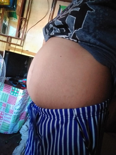 Tummy