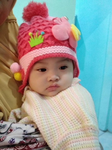Hidung tersumbat