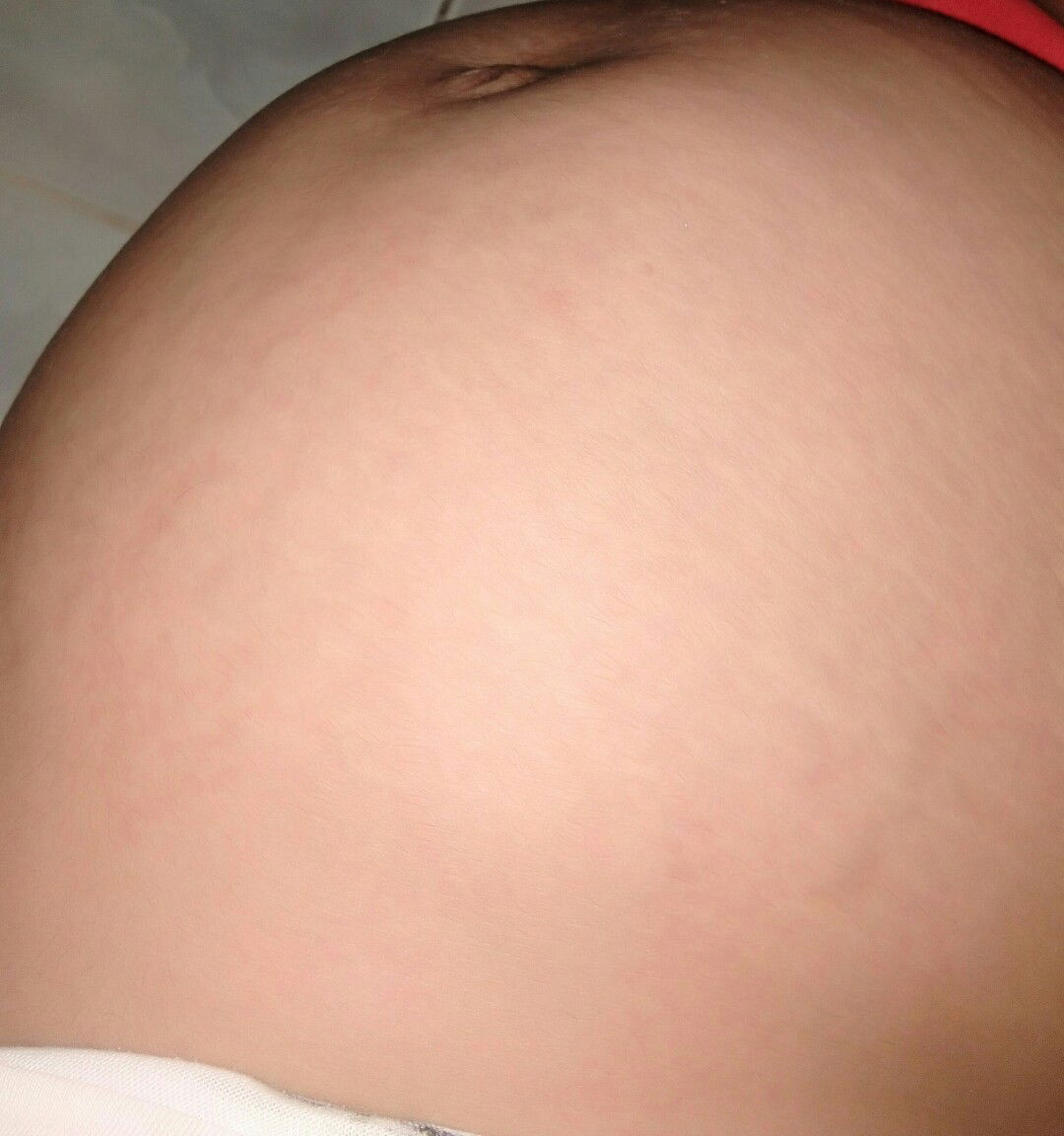 24 weeks and 1day❤