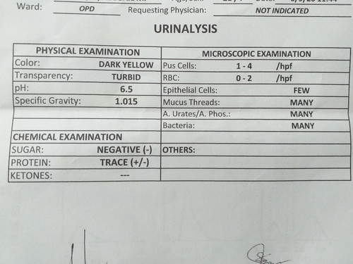 Urinalysis result.