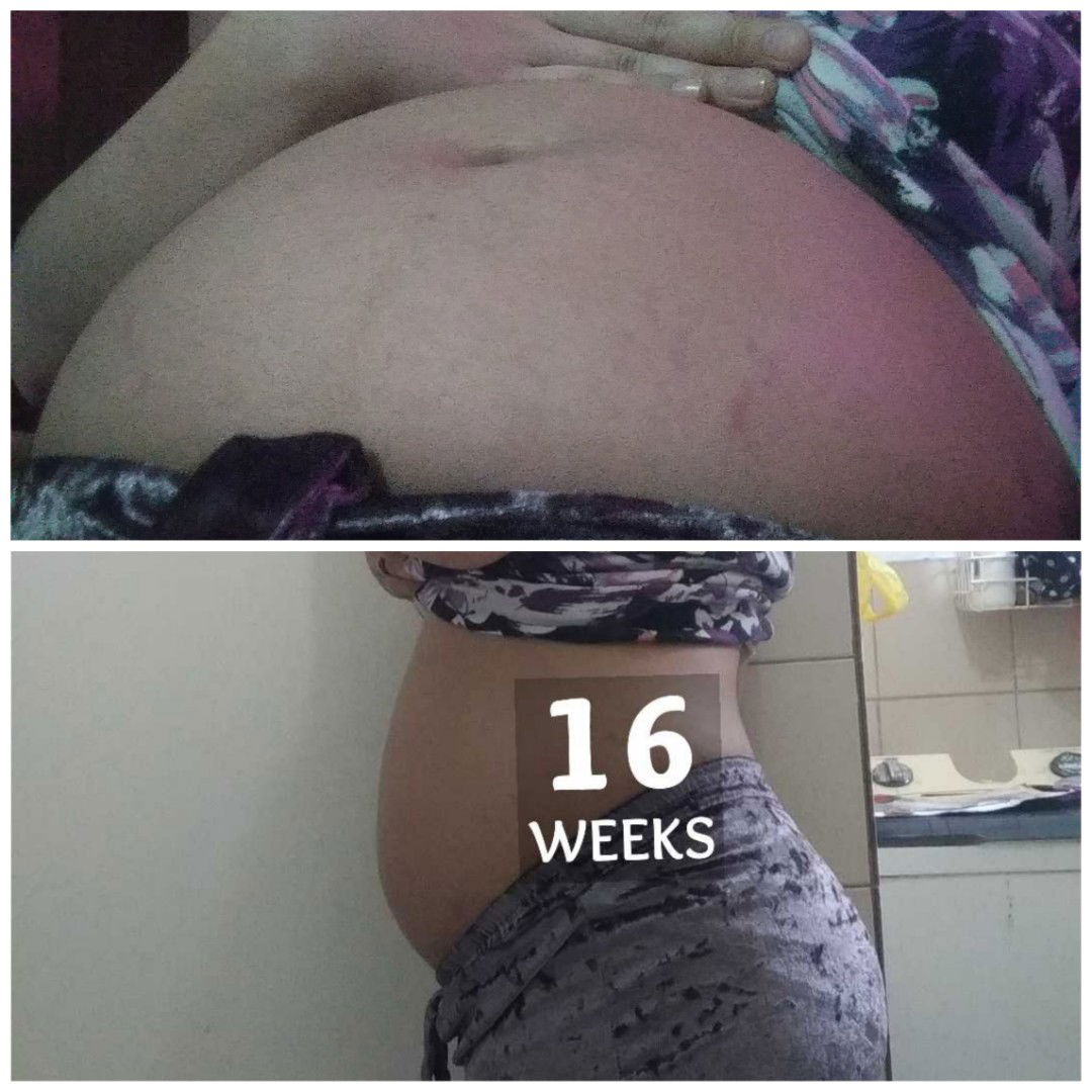 16W PREGGY MAY STRETCH MARKS NA AGAD