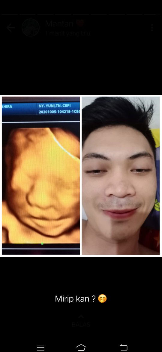 Yuni Revala Yuniar profile icon