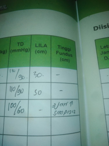 Tinggi Fundus