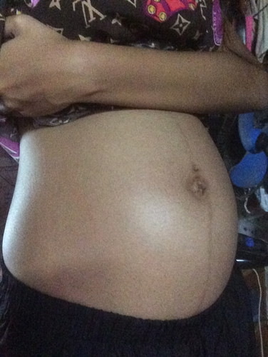 ดิ้นไม่บ่อย แต่เวลาดิ้นดิ้นแรง อันตรายไหมคะ