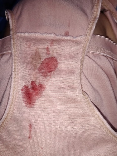 blood stain