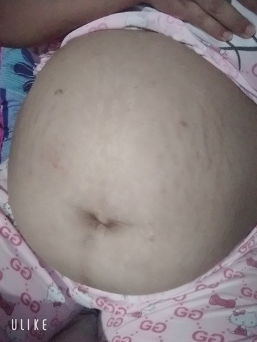 เพศลูก