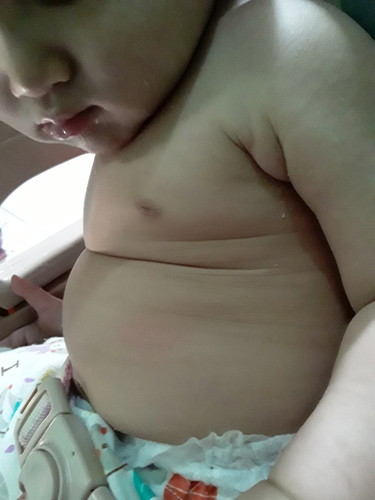 Perut Bayi