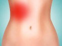 Abdominal pain