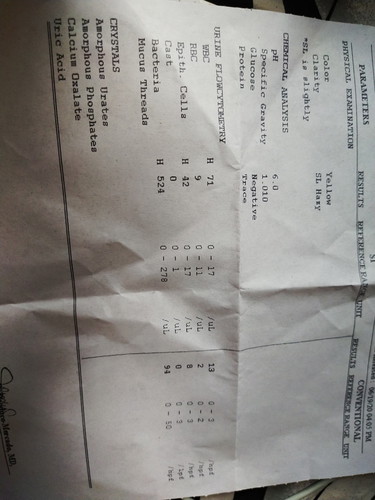 Urine test pacheck naman ano po ibigsabihin?
