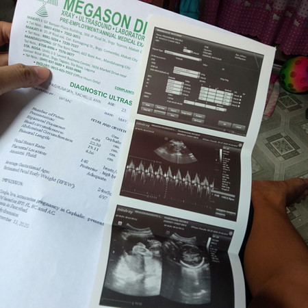 ultrasound.