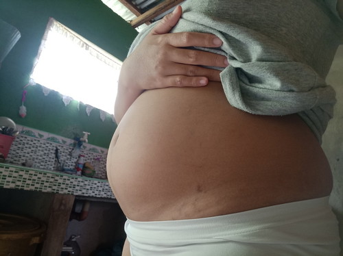 TUMMY