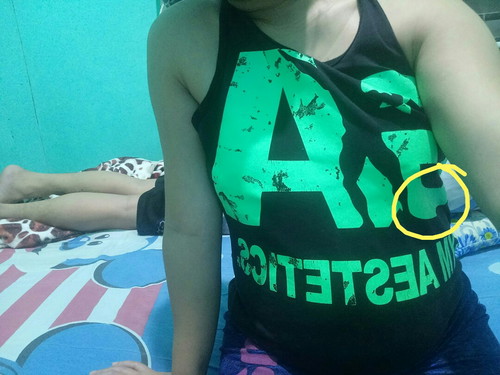 masakit sa left side ko