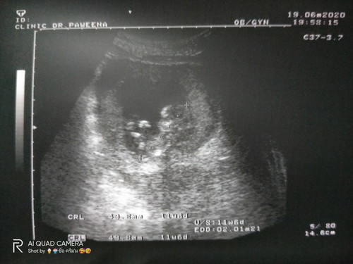 ความรู้สึกของคนเป็นแม่