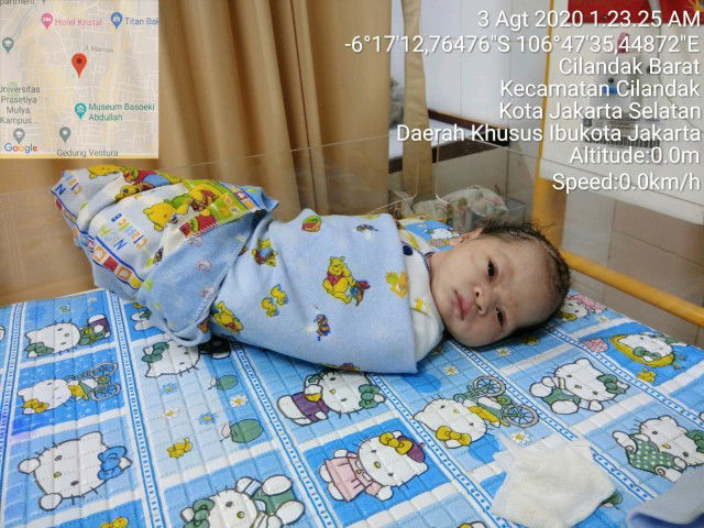 gak jadi sesar lahiran normal