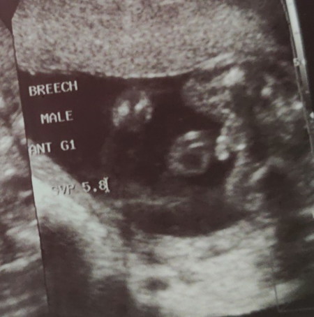 BABY BOY π