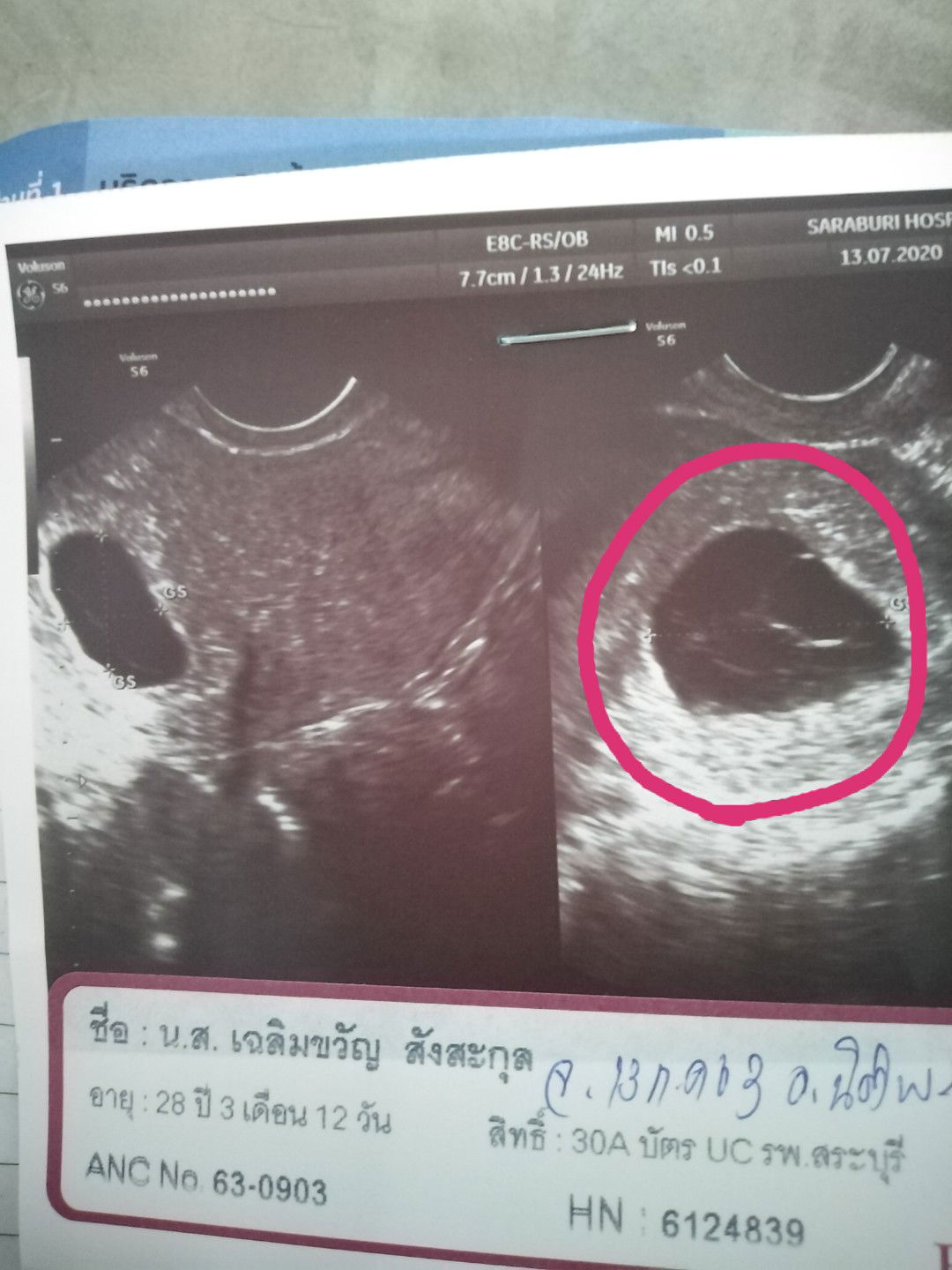 ขอปรึกษา​คุณแม่ท่านอื่นค่ะ