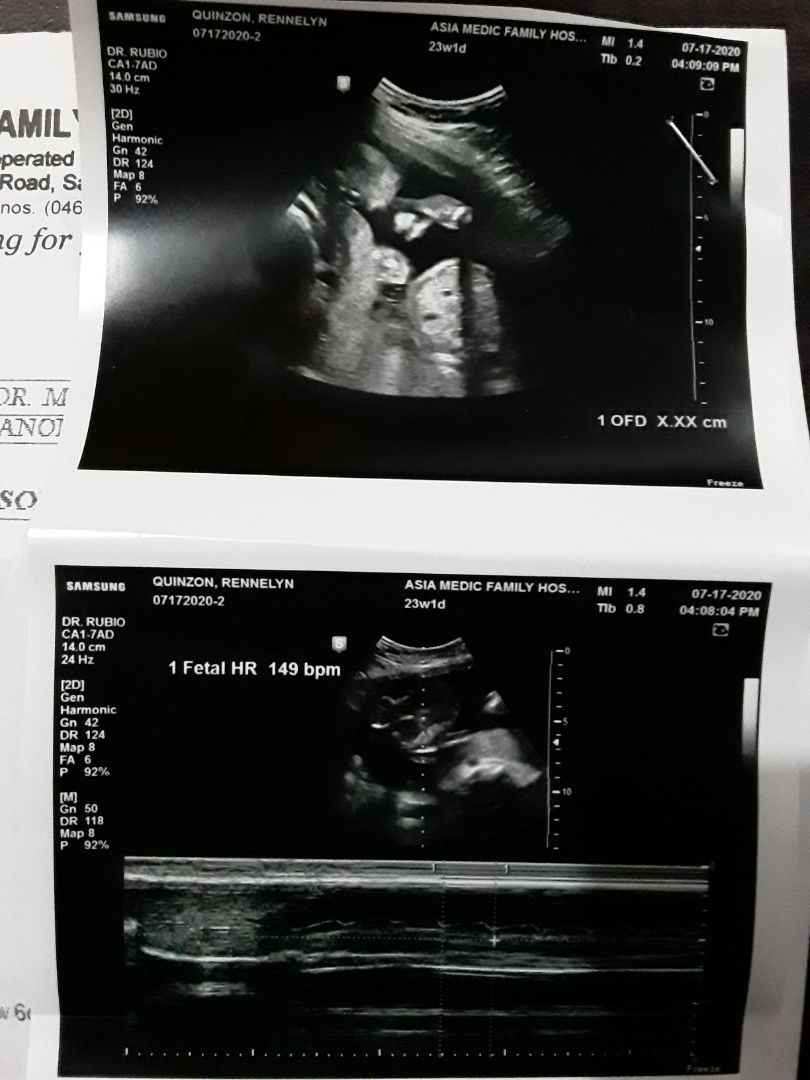 week 23 ultrasound girl or boy?