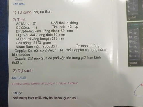 chuyện mang thai