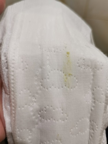 Yellow/ greenish Discharge