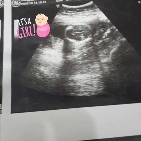 6เดือนแล้วค่ะ#ร่วมกิจกรรม#รถเข็นเด็ก#