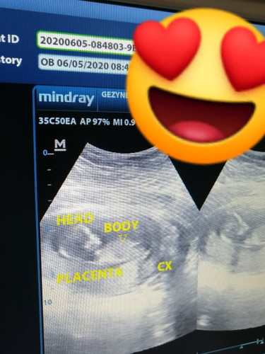 12 weeks and 3 days