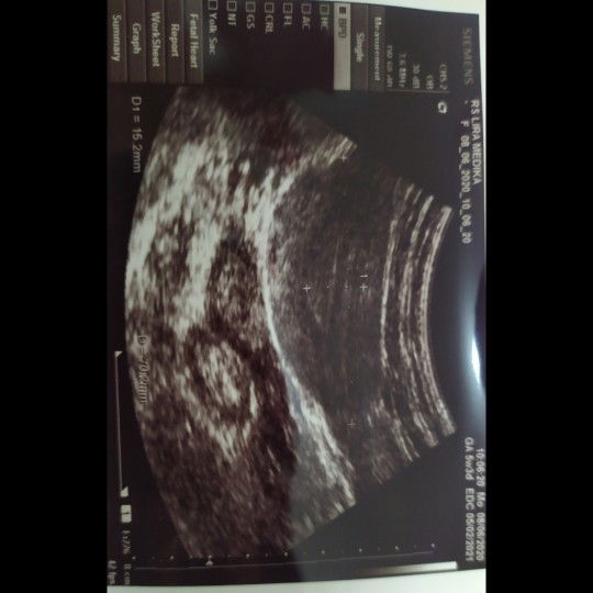 Belum ada kantong, itu hamil belum?