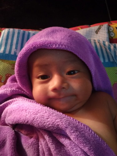 bagaimana cara mengatasi kolik pada baby ?