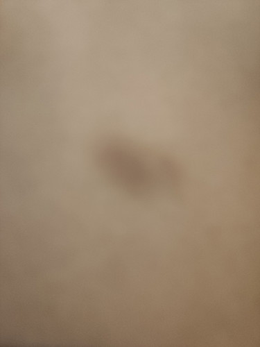 MINI BRUISES
