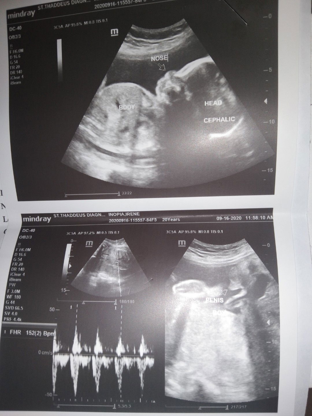 Irene Doquila Inopia II profile icon