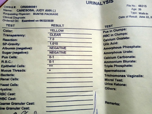 urinalysis