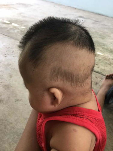 หัวแบน?