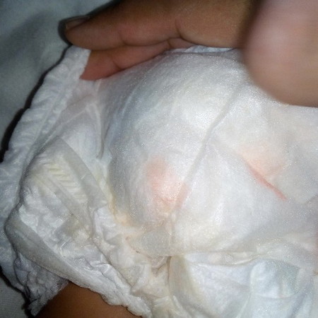 ลูกมีเลือดปน