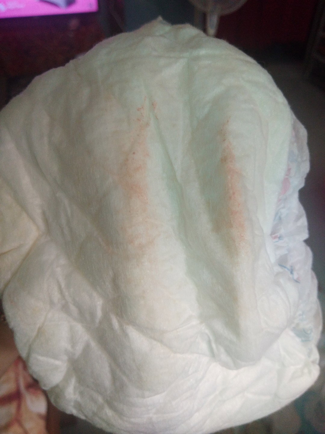 bayi 4 bulan urin bayi bercampur bercak merah