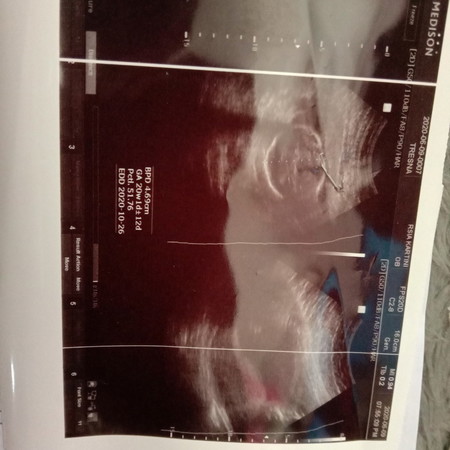 kondisi kesehatan janin