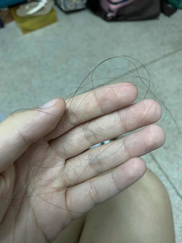ผมร่วง😩