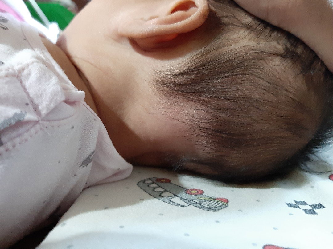 rụng tóc