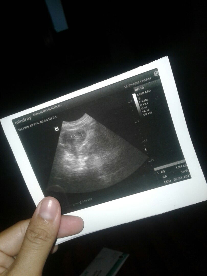 flek di usia 6week3d