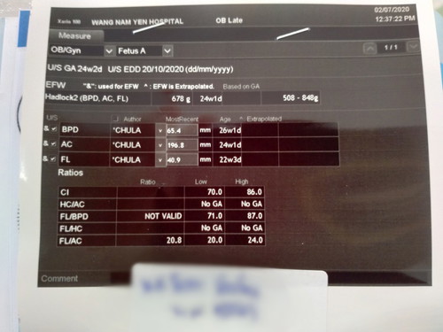 ฉันอยากรู้ว่าฉันตั้งครรถ์ได้กี่เดือนเเล้ว